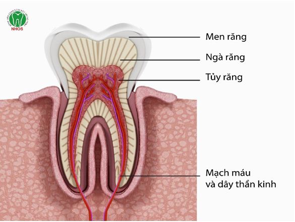 Các bước cơ bản trong điều trị tủy răng chưa đóng chóp là gì?
